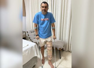 Governador Wanderlei Barbosa sofre lesão no joelho durante partida de futebol