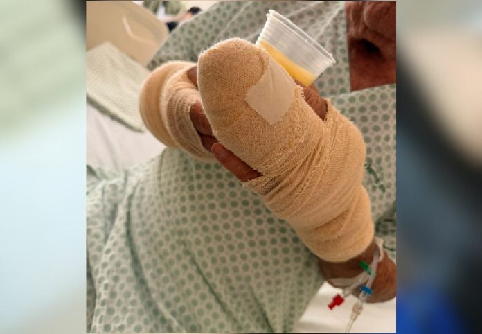 Idoso atacado por pitbull em Palmas vai passar pela quarta cirurgia em dez dias, diz neta