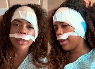 Marvvila volta aos palcos após retirar tumor no ouvido: ‘Sentia dor até para colocar fone’