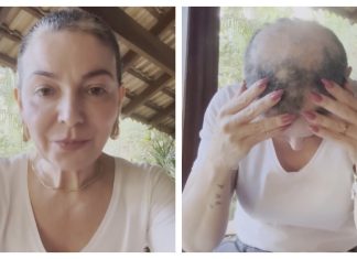 Mãe de Lucas Lucco revela volta de alopecia areata e desabafa nas redes: ‘Vou seguir firme’